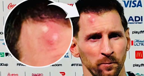 OKFUN đổi thưởng và khoảnh khắc Messi sưng trán gây chú ý tại World Cup 2026 - hình ảnh - okfun.vn OKFUN đổi thưởng và khoảnh khắc Messi sưng trán gây chú ý tại World Cup 2026 - hình ảnh - okfun.vn